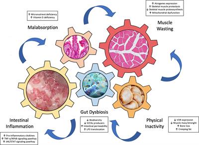 Inflammatory Bowel Diseases and Sarcopenia: The Role of Inflammation and Gut Microbiota in the Development of Muscle Failure